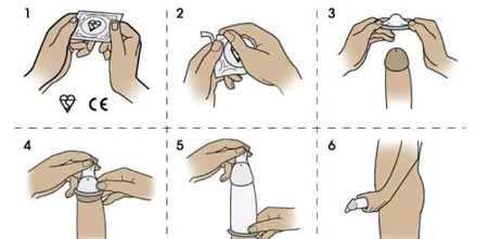 Cách sử dụng bao cao su nam.